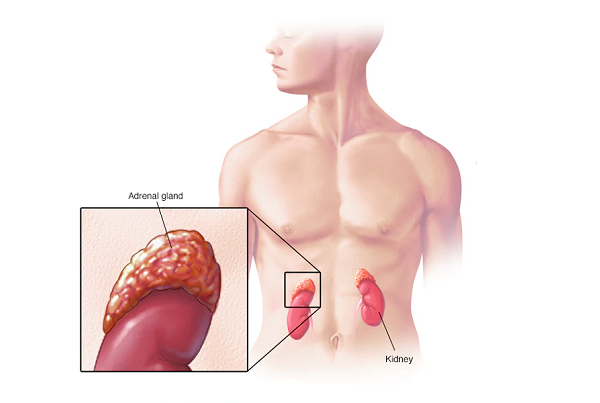 Adrenalectomy